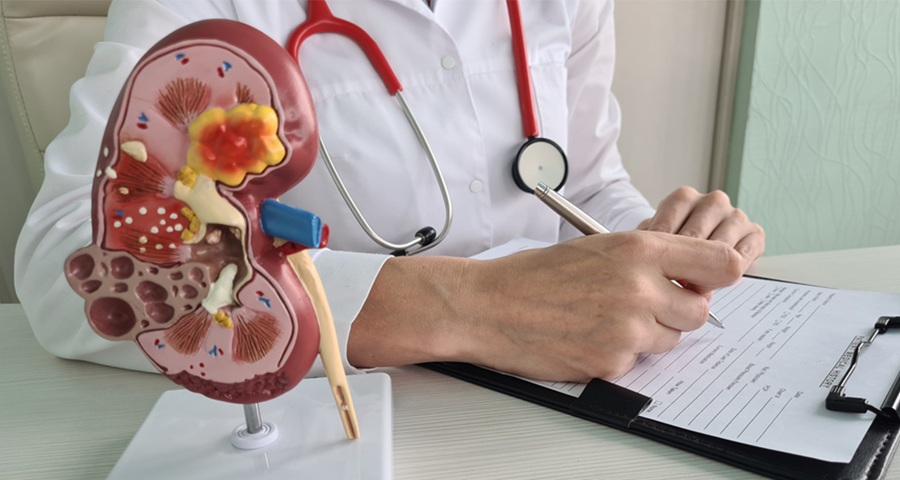 Are Your Medications Damaging Your Kidneys? Learn Safer Alternatives